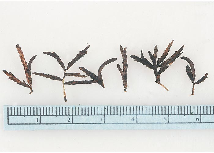 Cardiovascular system