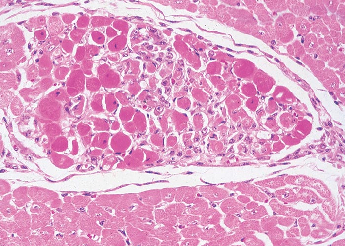 Cardiovascular system