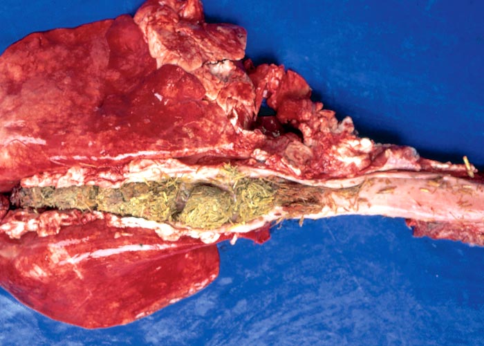 Gastrointestinal tract