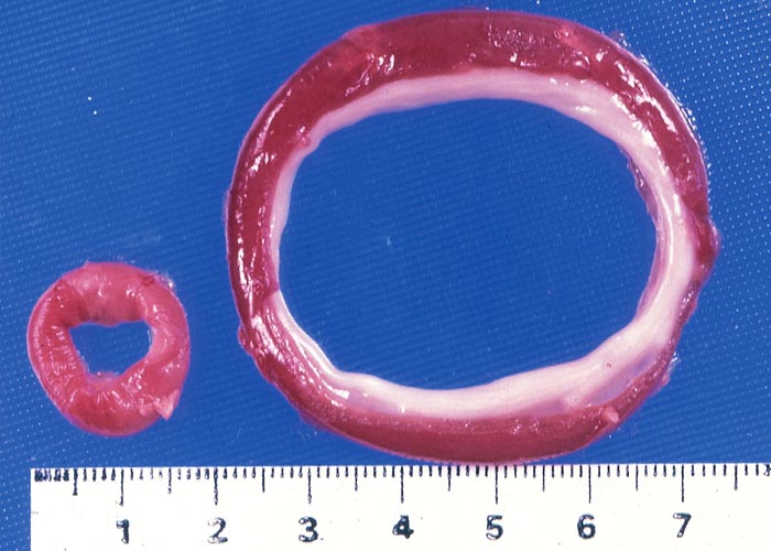 Gastrointestinal tract