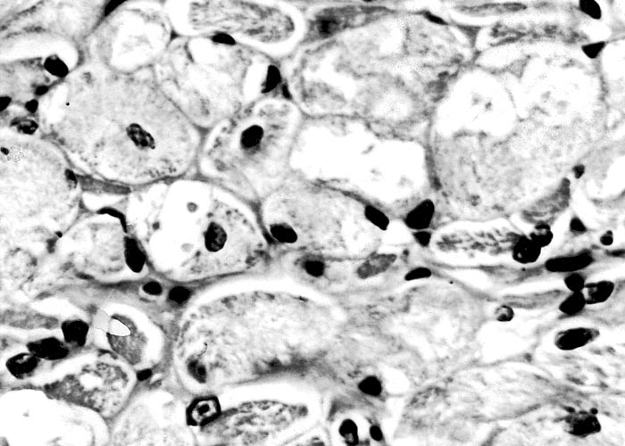 Gastrointestinal tract