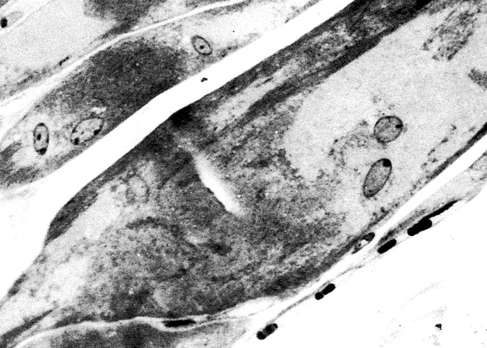 Gastrointestinal tract