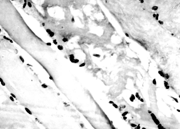 Gastrointestinal tract