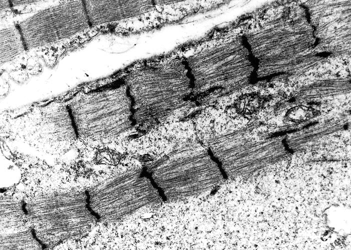 Gastrointestinal tract