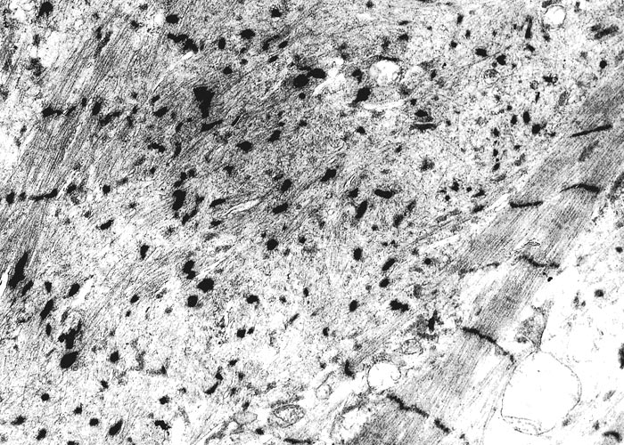 Gastrointestinal tract