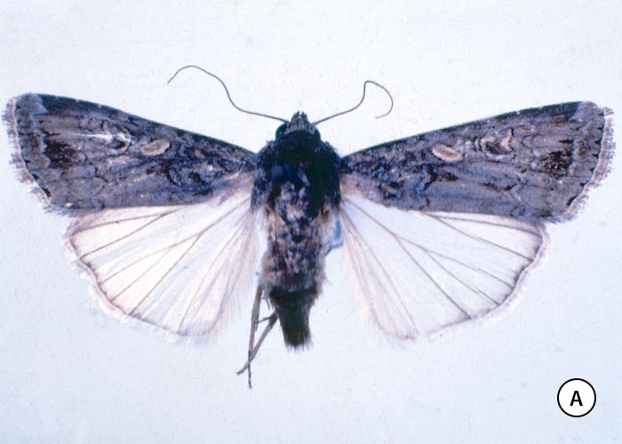 Gastrointestinal tract