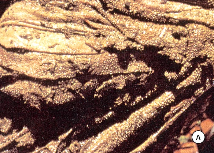 Gastrointestinal tract