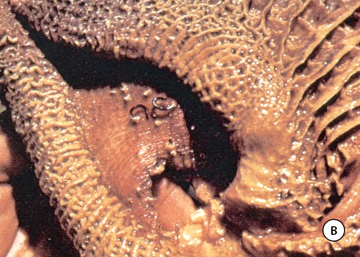 Gastrointestinal tract