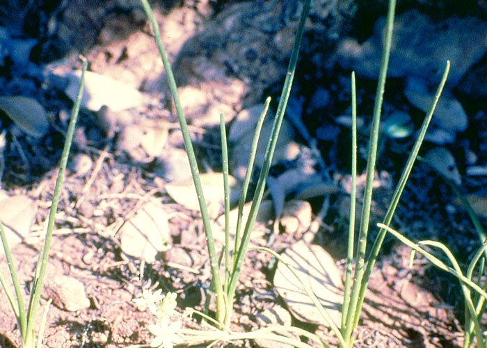 Gastrointestinal tract