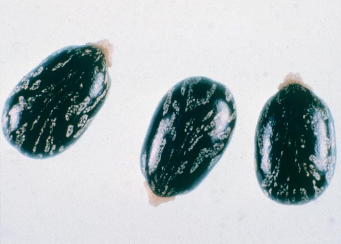 Gastrointestinal tract