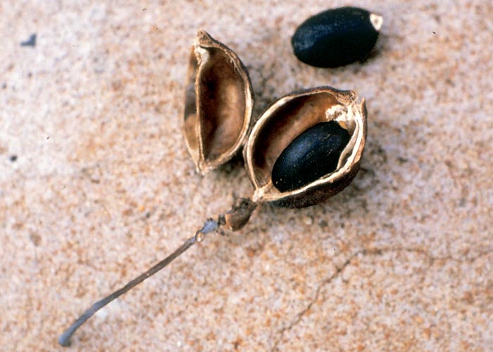 Gastrointestinal tract