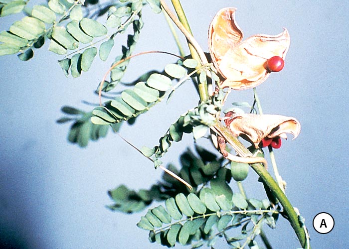 Gastrointestinal tract