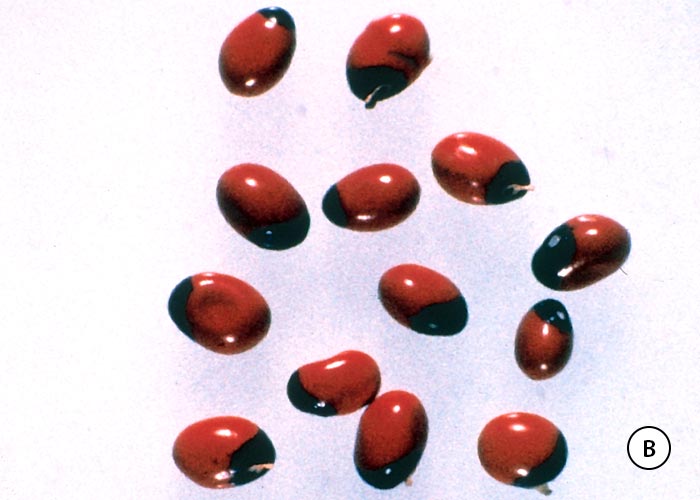 Gastrointestinal tract