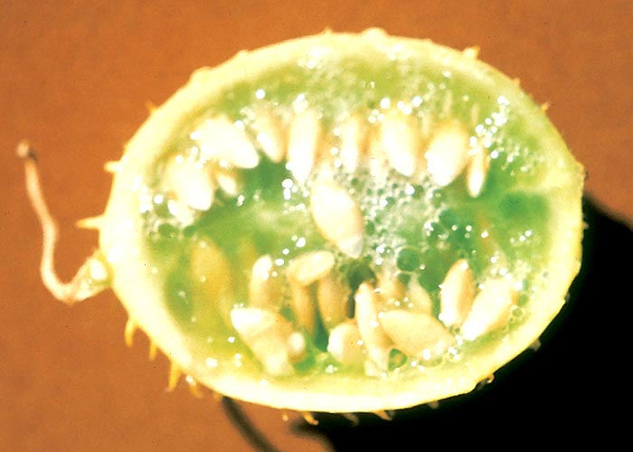 Gastrointestinal tract