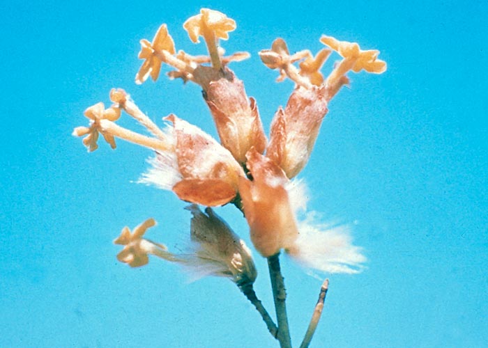 Gastrointestinal tract