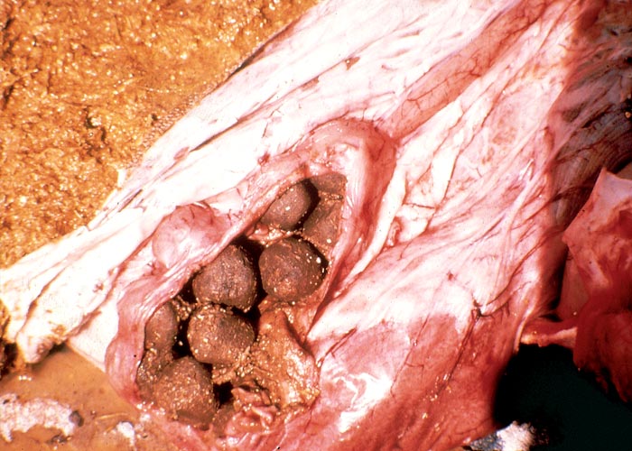 Gastrointestinal tract