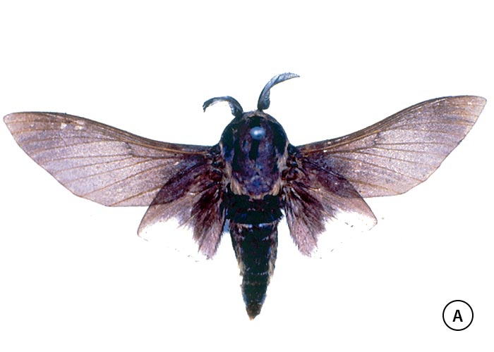 Gastrointestinal tract