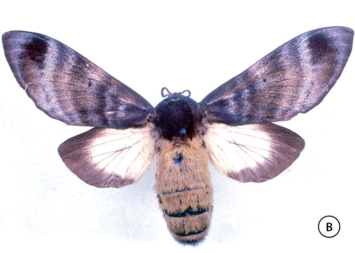 Gastrointestinal tract