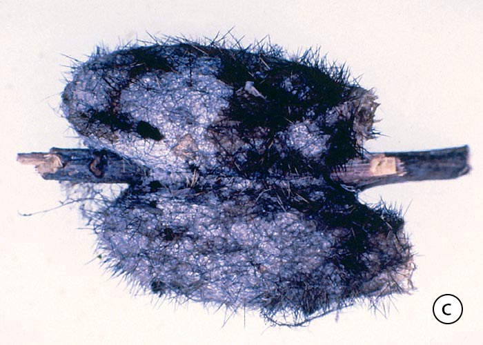 Gastrointestinal tract