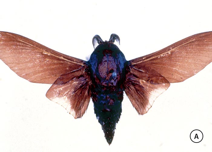 Gastrointestinal tract