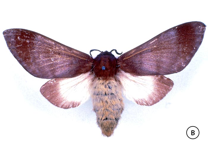 Gastrointestinal tract