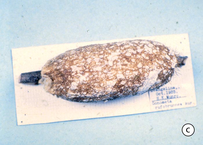 Gastrointestinal tract