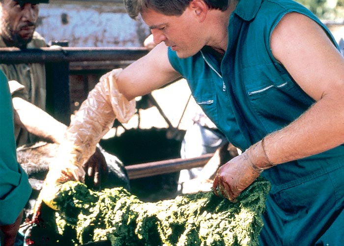 Gastrointestinal tract