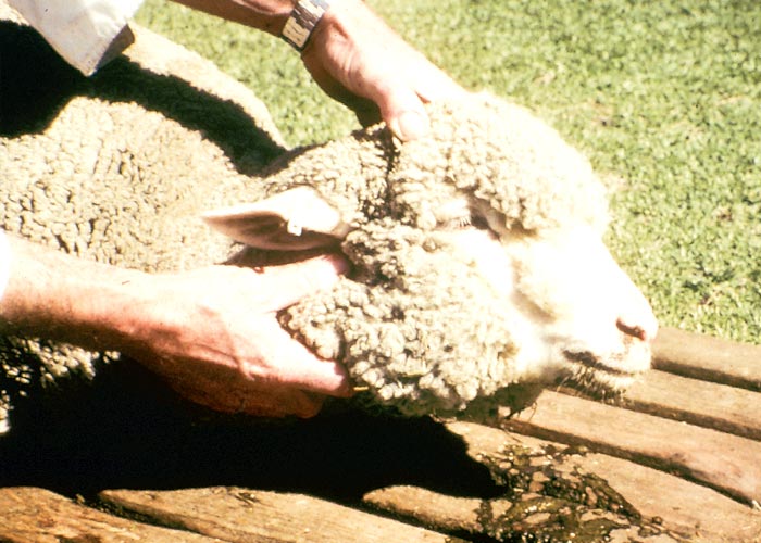 Gastrointestinal tract