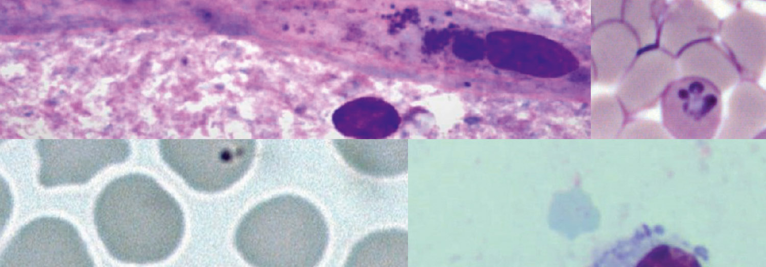 Thin blood smears from infected bovines showing Babesia bigemina, Anaplasma marginale, a brain crush smear showing Ehrlichia ruminantium and a lymph node biopsy smear showing a Theileria macroschizont.