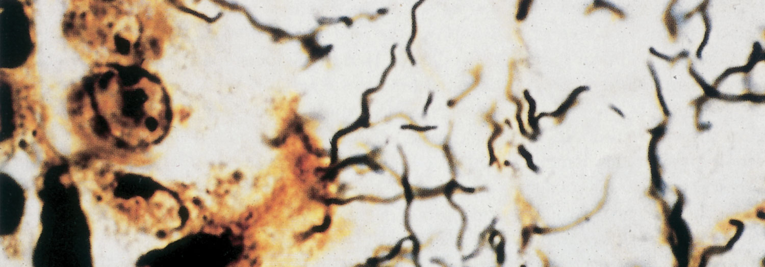 Leptospirosis