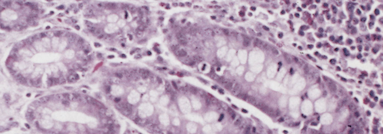 Proliferative enteropathies of pigs