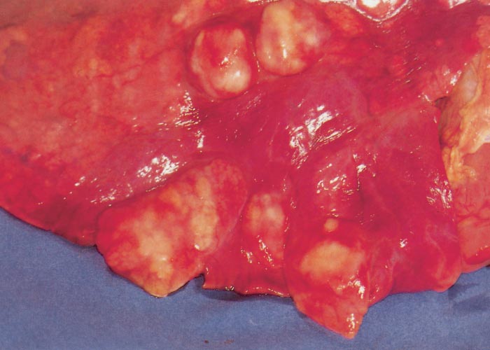 Rhodococcus equi infections