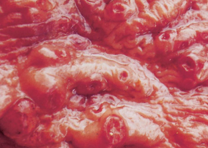 Rhodococcus equi infections