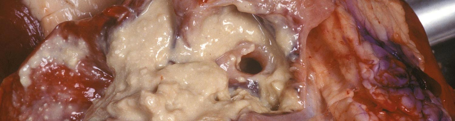 Corynebacterium pseudotuberculosis infections