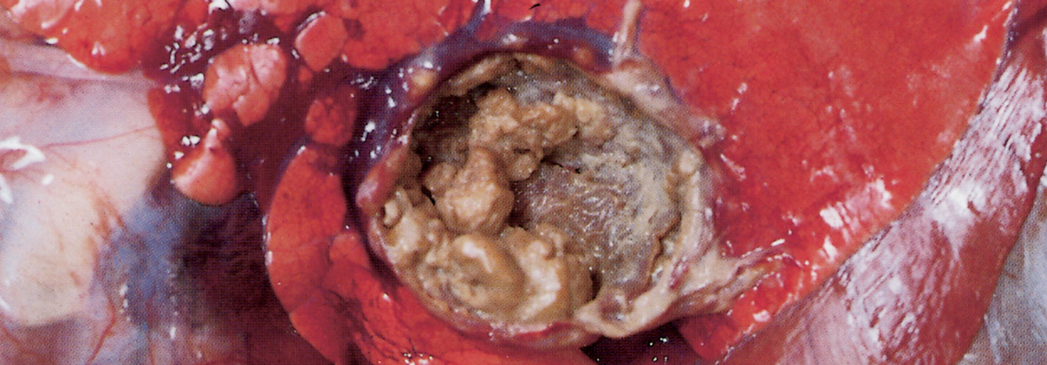 Trueperella pyogenes infections