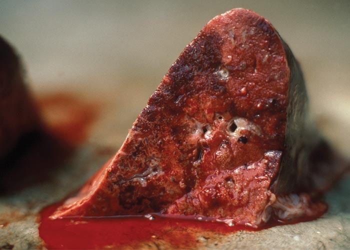 Contagious caprine pleuropneumonia