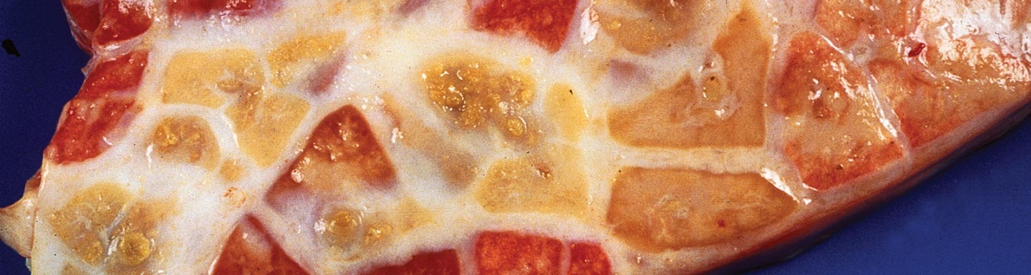 Contagious bovine pleuropneumonia