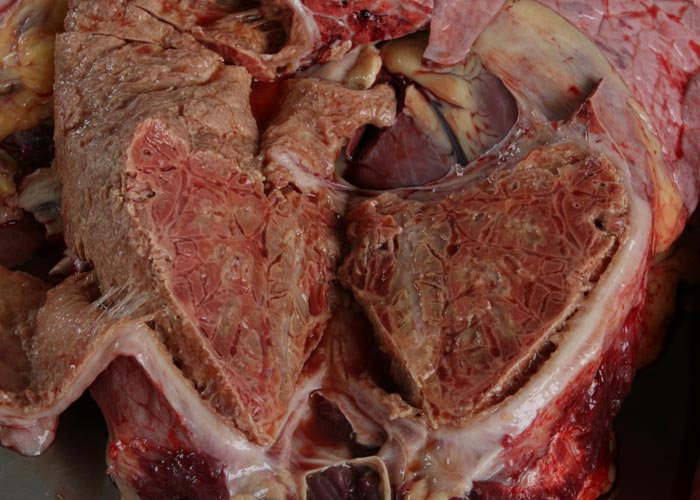 Contagious bovine pleuropneumonia